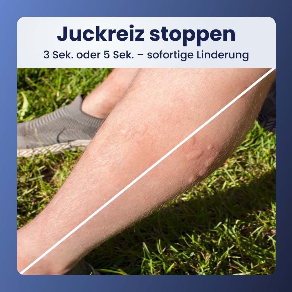SimplyZap image